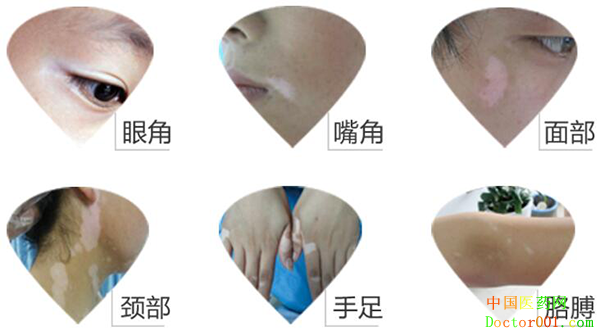 1533089230785098.png 图片2.png