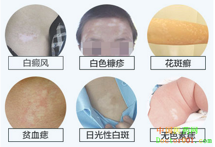 1533089189545088.png 图片1.png