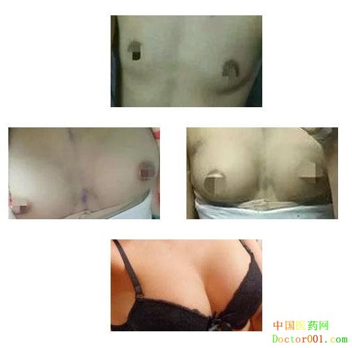 ����ѩ�������ܷ���