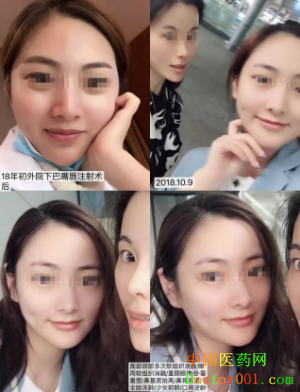 QQ��ͼ20181123125722.png