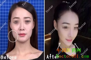 QQ��ͼ20181123170231.png