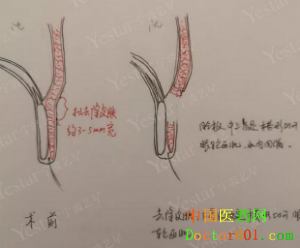 QQ��ͼ20181124091446.png