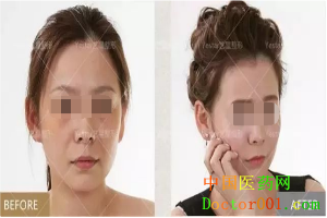 1546837246637910.png QQ截图20181123134814.png