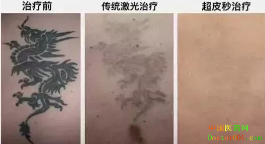 1546837228958381.png QQ截图20181123134617.png