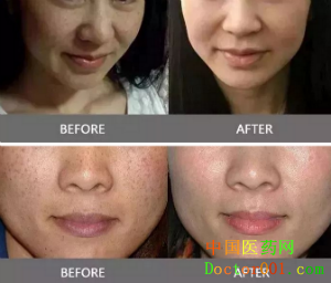 1546837250304910.png QQ截图20181123170231.png