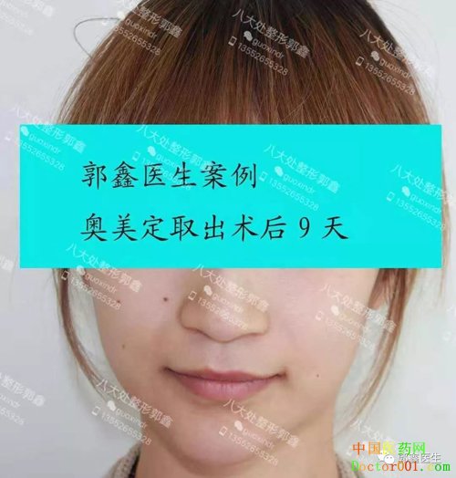 24.webp.jpg