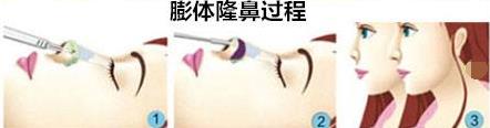30F10F13-E16D-4af9-A119-2C0E4E18C5A6.jpg
