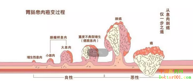 1554708905499882.png image.png