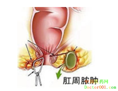 һ�����ŧ��΢����������Ǯ