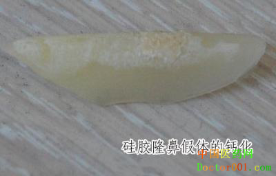 blob.png