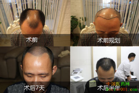 QQ��ͼ20190413170601.png