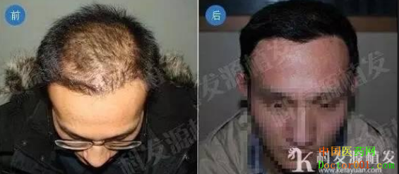 QQ��ͼ20190418153049.png