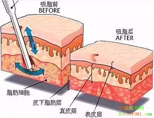 1570607347832745.jpg 640.webp (1).jpg