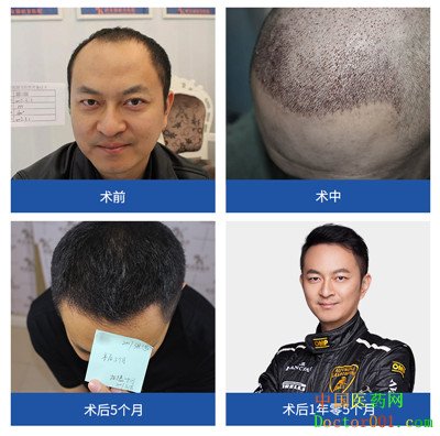 QQͼƬ20190118111217_����.jpg