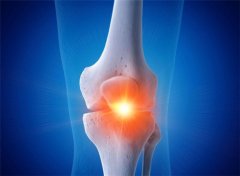 �ǹؽ��׻��߾���ָ�ϣ����ᰱ�Ǻ����ᰱ�ǵ��������